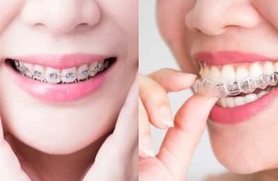 orthodontics-panmure-classics-dental-auckland-2