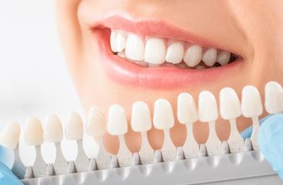 zirconia-crown-panmure-auckland